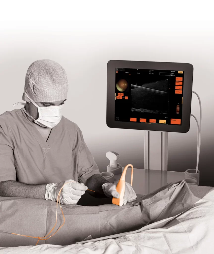 interventional-imaging-by-lumibird-medical-7-starscope