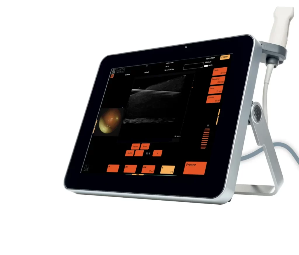 starscope ultrasound interventional imaging device